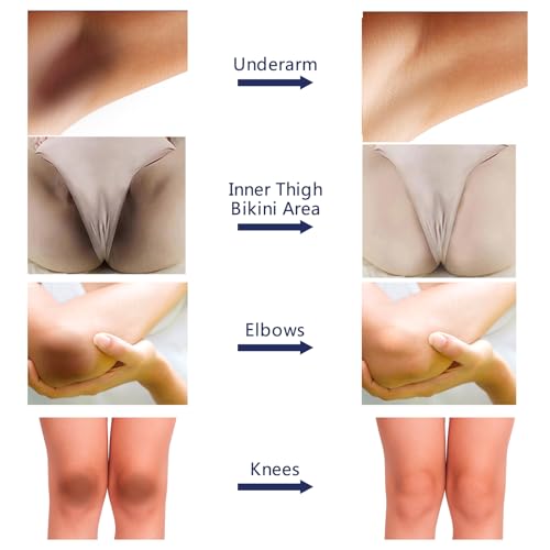 Crema blanqueadora para aclarar la piel para áreas íntimas sensibles al cuerpo, partes privadas, axilas, rodillas, codos, muslos internos, áreas de bikini, crema blanqueadora de piel removedor de